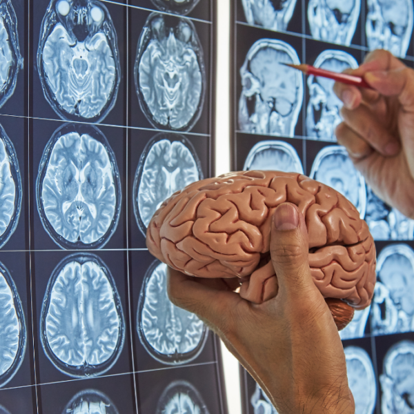 Science Discovers That the Brain Regenerates Even in Adulthood