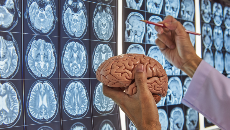 Science Discovers That the Brain Regenerates Even in Adulthood